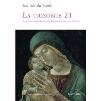 La trisomie 21: Perspective historique sur son diagnostic et sa compréhension de Jean-Adolphe Rondal